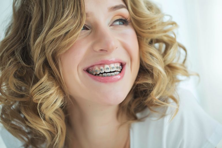 Debunking the Most Common Myths That Exist About Dental Braces