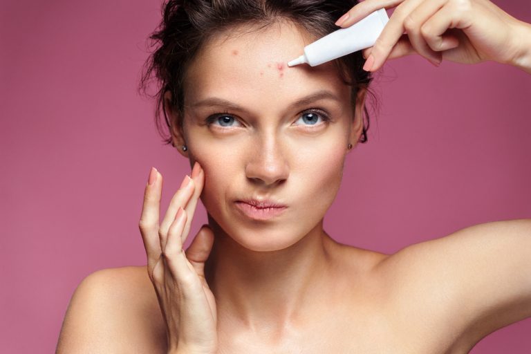Blackheads vs Whiteheads on Skin: What Can You Do?