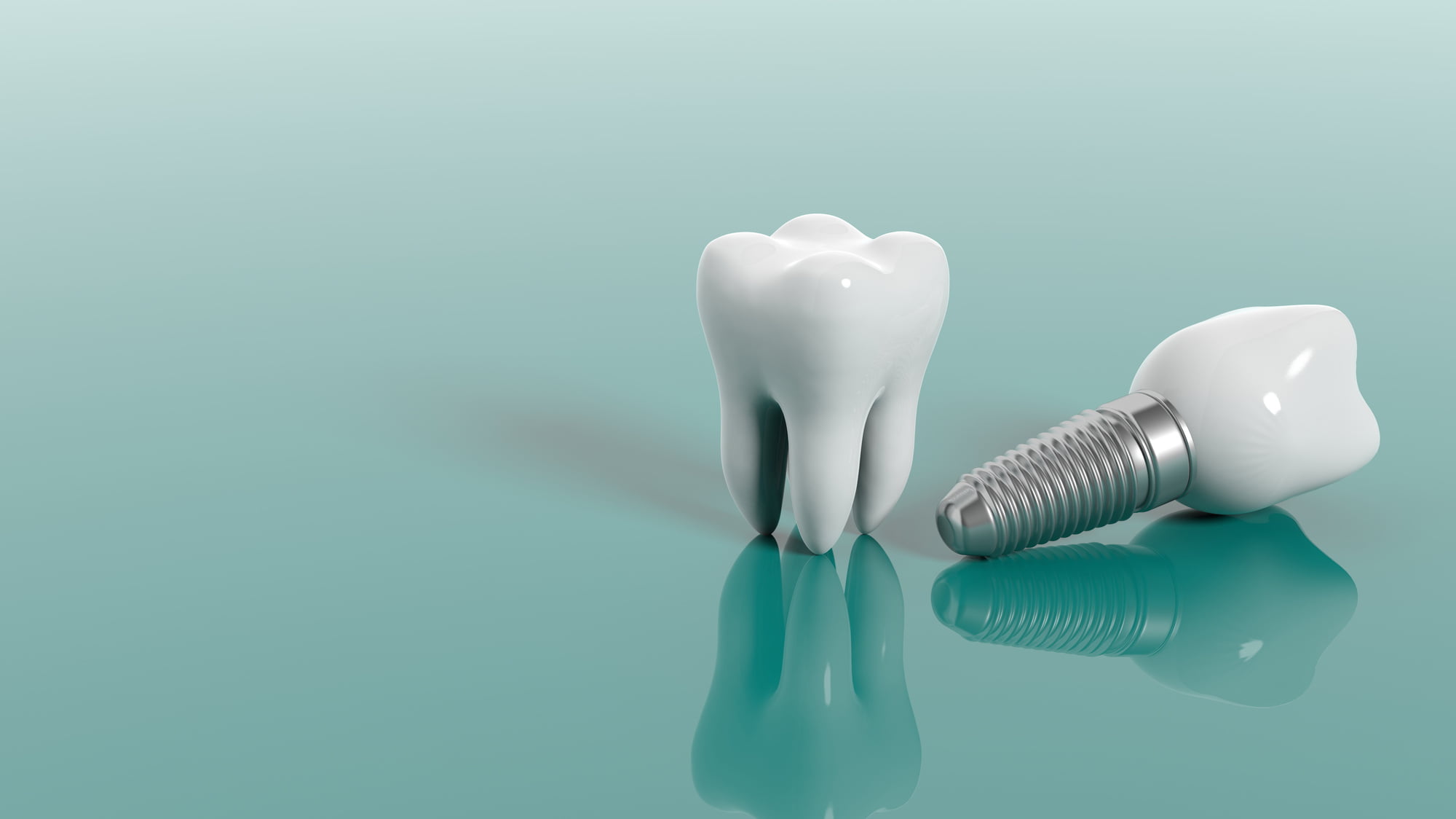 There are several reasons why people get dental implants, but how much do dental implants cost? These are the prices you can expect.