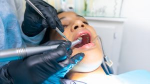 The Brief Guide That Makes Choosing the Best Dentist Simple