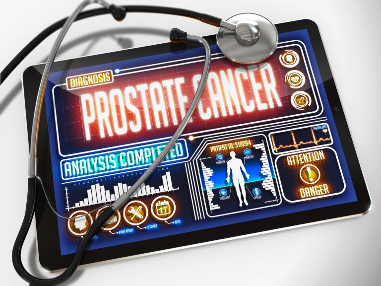 5 Warning Signs of Prostate Cancer: Your Essential Guide