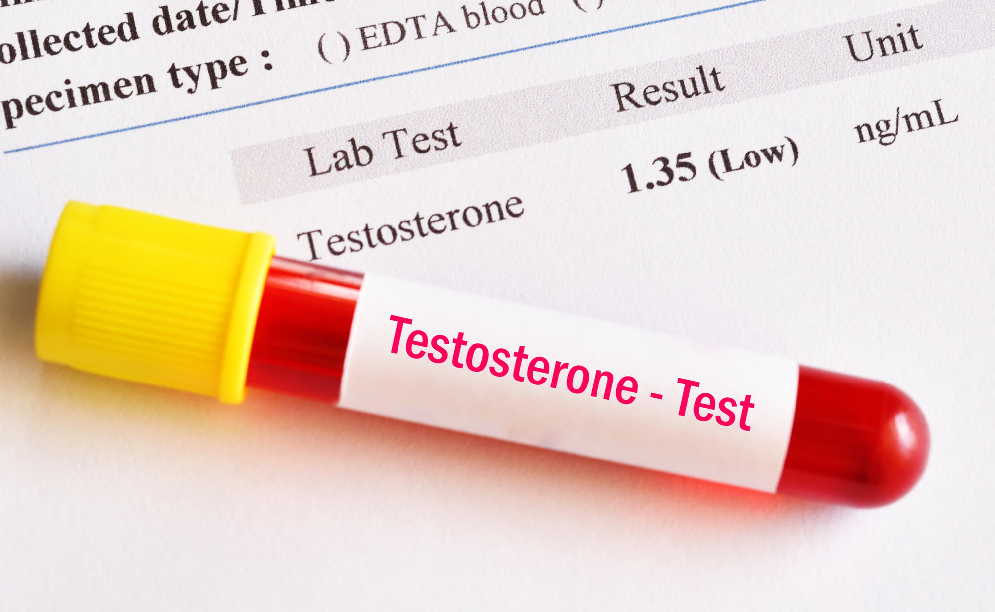 Are you looking for the right treatment to address your low testosterone? Is testosterone therapy safe? Find your answers here.