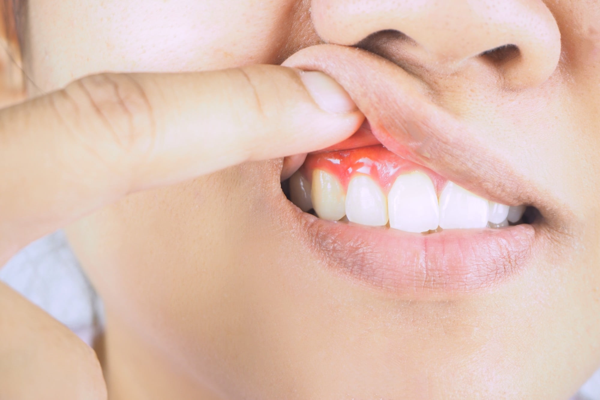 Do you know the signs and symptoms of early stage gum disease? Check out our guide as we look at the top signs, plus how to prevent gum disease today.