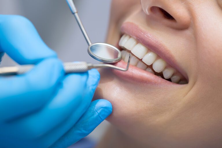 How Do I Choose the Best Dentist in My Local Area?
