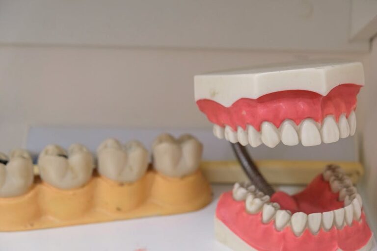 What Are the Advantages of Wearing Partial Dentures?