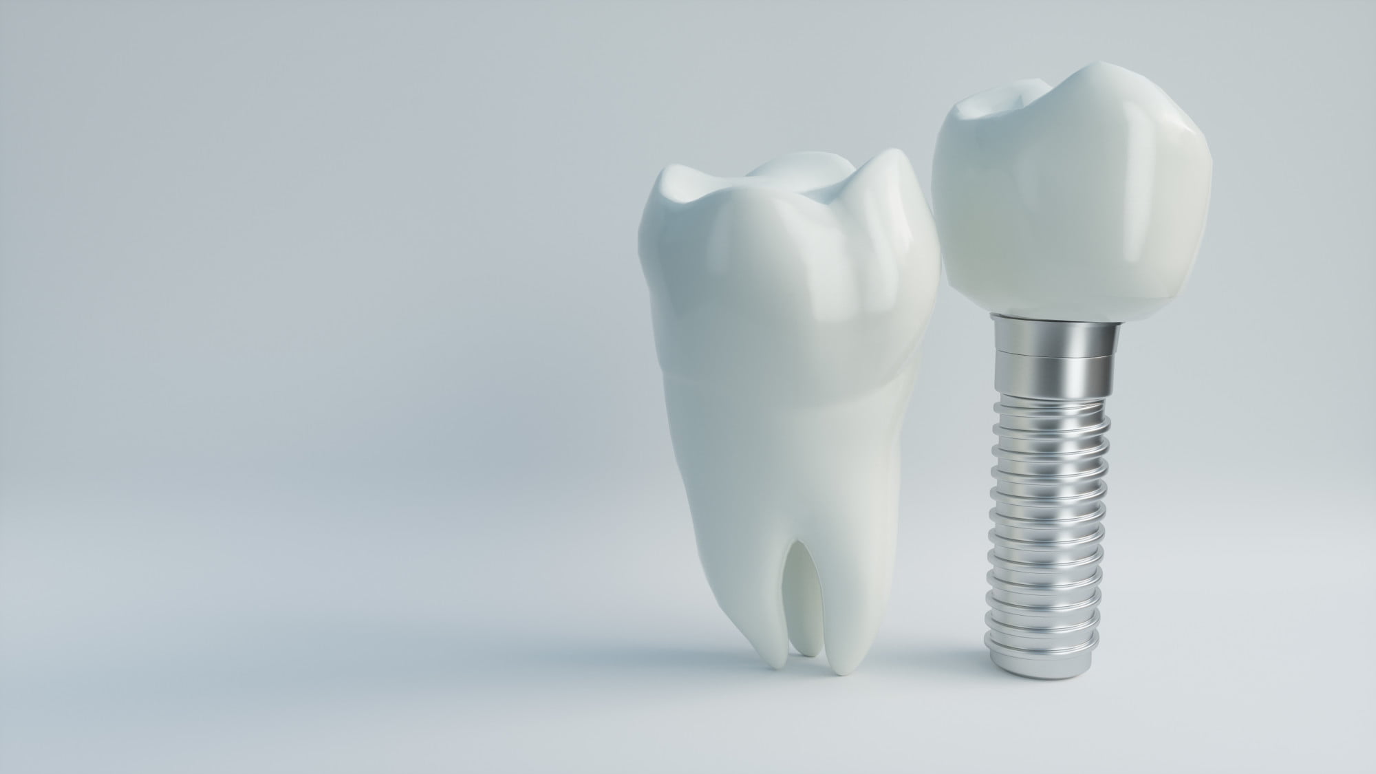 When it comes to supporting your dental implants with additional bone transplanted into the jawline, find out if you'll need a bone graft.