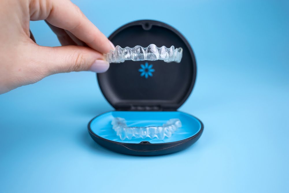 How Invisalign Is Revolutionizing Dental Treatment: A Closer Look at the Technology